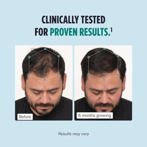 Nutrafol Men Hair Growth Supplement for Thicker, Stronger Hair (4 Capsules Per Day - 1 Month Supply)