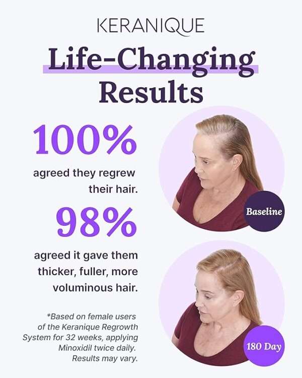 Keranique Hair Regrowth Treatment for Women - 2% Minoxidil for Hair Growth & Thickening - Topical Solution